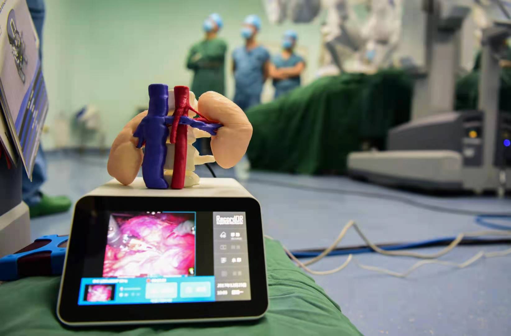 3DプリントPEEKステントがナットクラッカー症候群治療を革新